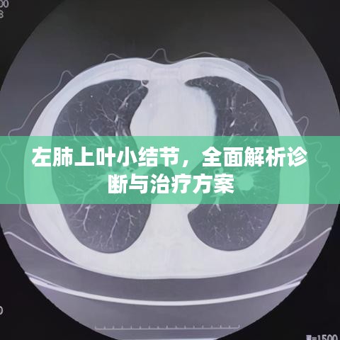 左肺上叶小结节，全面解析诊断与治疗方案