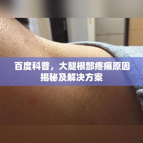 百度科普，大腿根部疼痛原因揭秘及解决方案