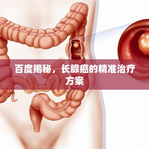 百度揭秘，长腺癌的精准治疗方案