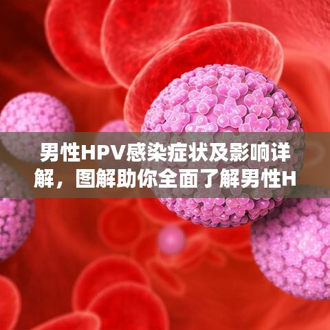 男性HPV感染症状及影响详解，图解助你全面了解男性HPV感染情况