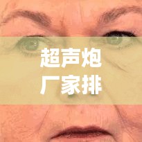 超声炮厂家排名前十深度解析与比较，行业洞察一网打尽！