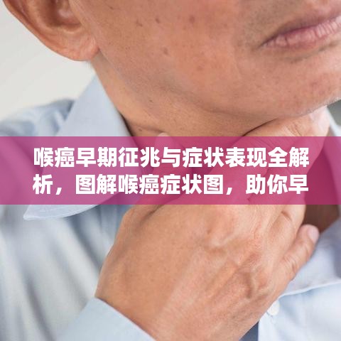 喉癌早期征兆与症状表现全解析，图解喉癌症状图，助你早期发现！